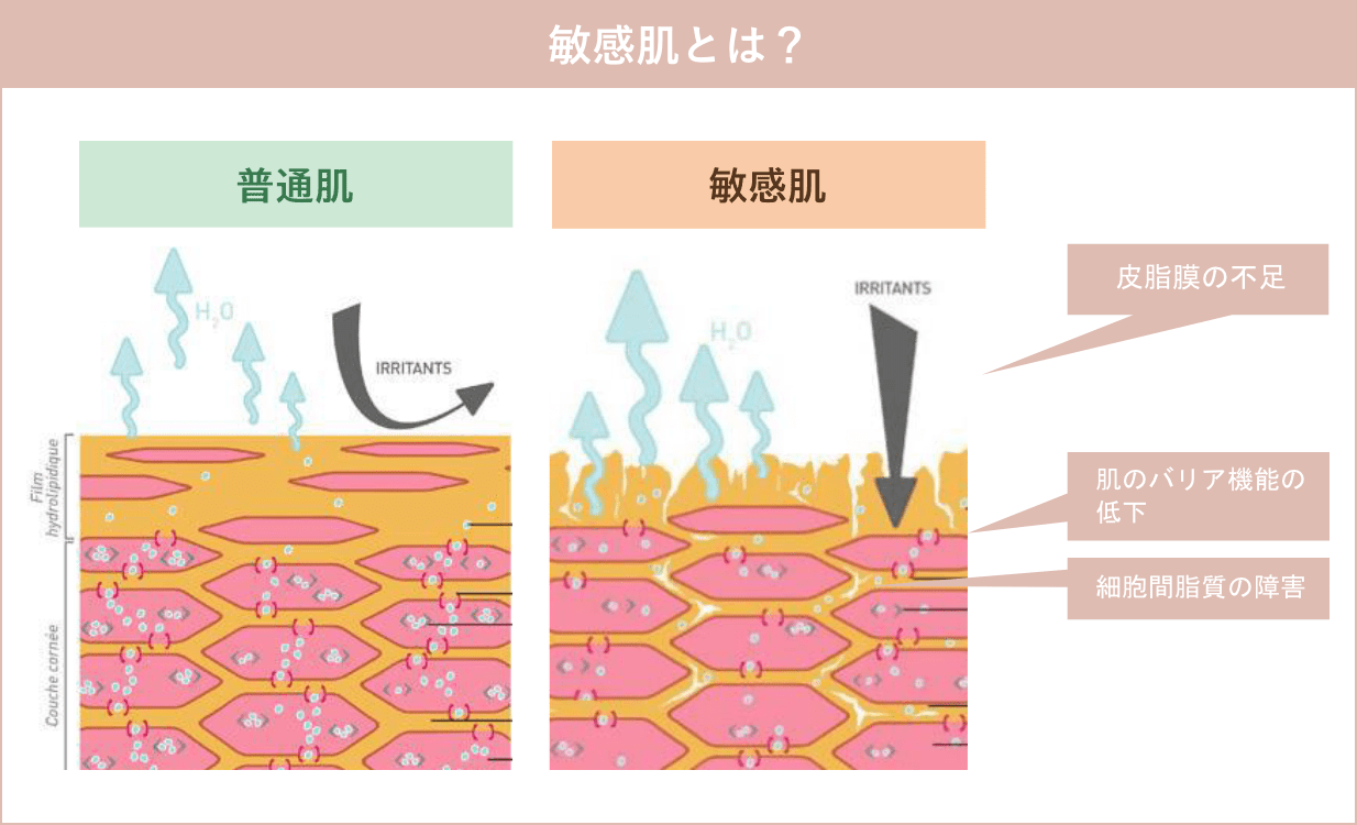 敏感肌とは